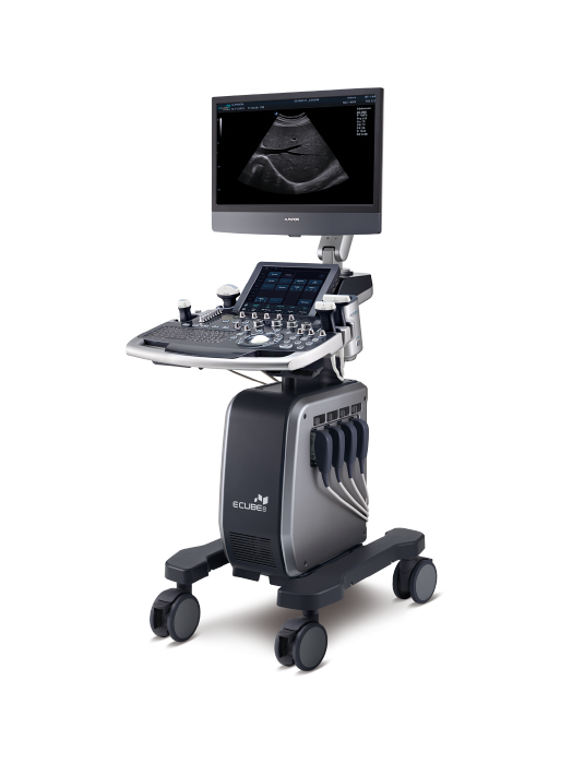 초음파 검사장비